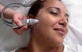 peeling de cristal