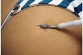 6 Sessões de eletrollinfiting