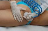6 sessões de vacoterapia